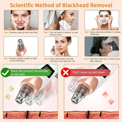 5-in-1 Electric Blackhead Remover